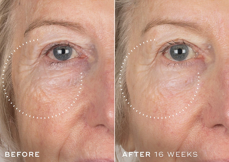 Beautiful Skin for Life